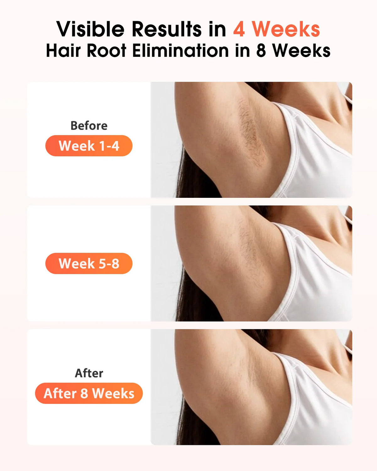 Dispositivos IPL Depilación Láser 17J 999900   Light Pulses HR/SC/RA 9 niveles Depilación indolora para todo el cuerpo Uso doméstico para hombres y mujeres